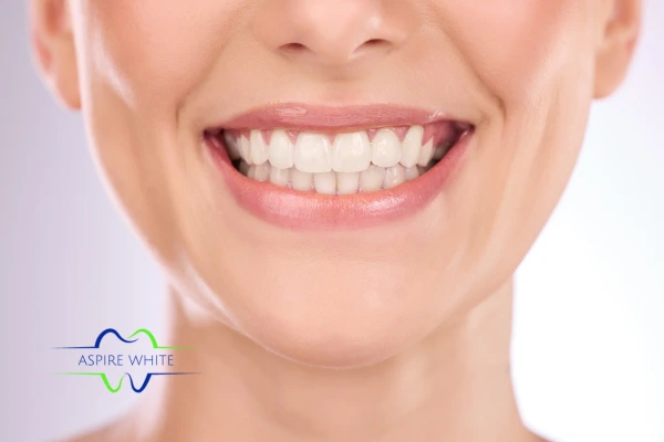 Follow your teeth whitening aftercare Ipswich to prolong your whiter smile!