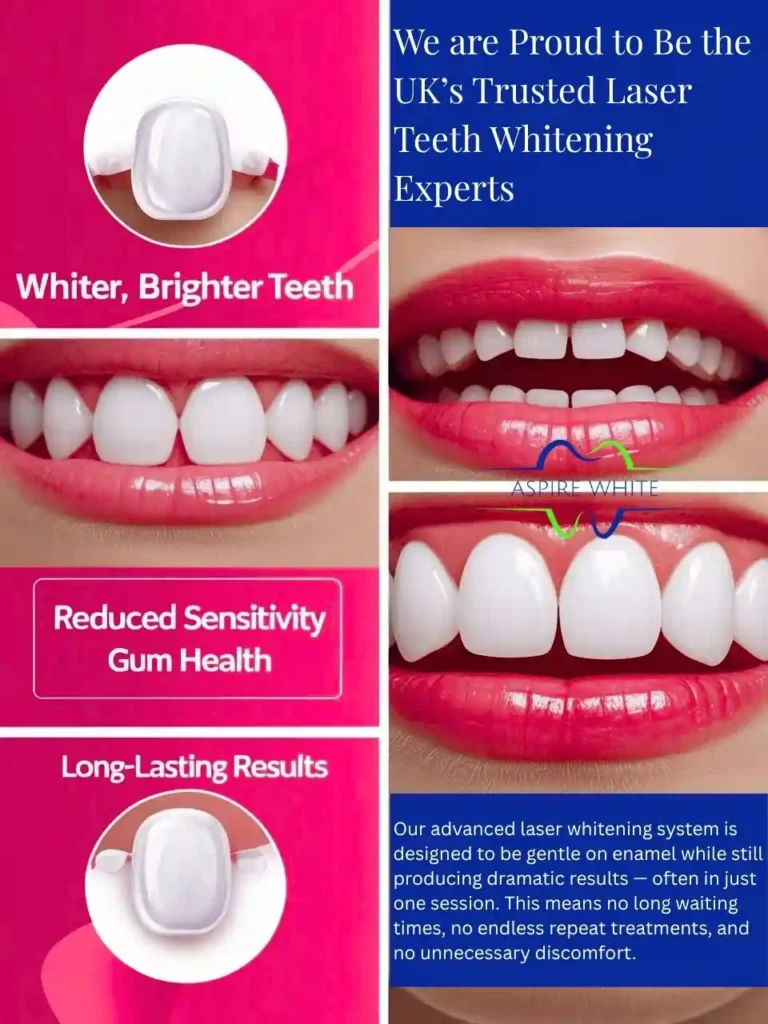 We are Proud to Be the UK’s Trusted Laser Teeth Whitening Experts Ipswich